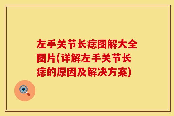 左手关节长痣图解大全图片(详解左手关节长痣的原因及解决方案)