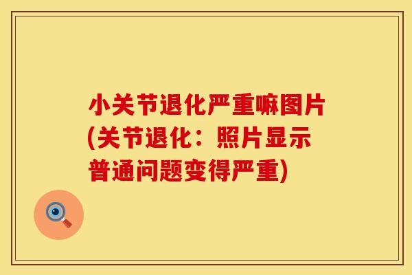 小关节退化严重嘛图片(关节退化：照片显示普通问题变得严重)