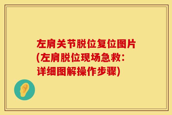 左肩关节脱位复位图片(左肩脱位现场急救：详细图解操作步骤)