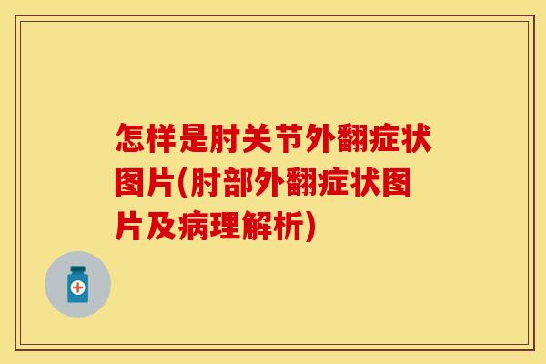 怎样是肘关节外翻症状图片(肘部外翻症状图片及病理解析)