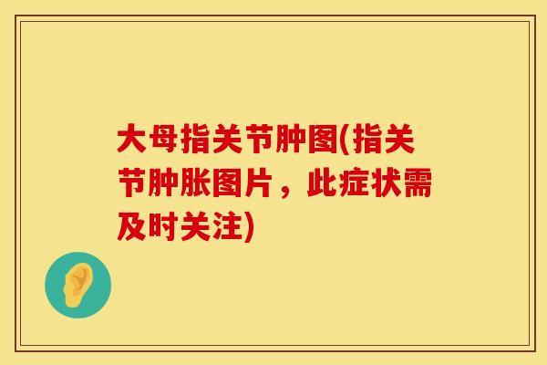 大母指关节肿图(指关节肿胀图片，此症状需及时关注)