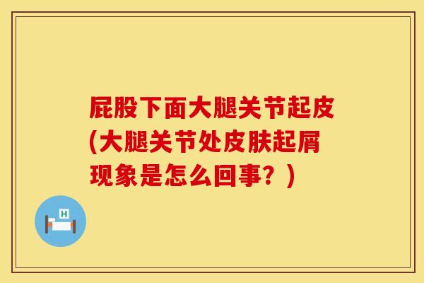 屁股下面大腿关节起皮(大腿关节处皮肤起屑现象是怎么回事？)