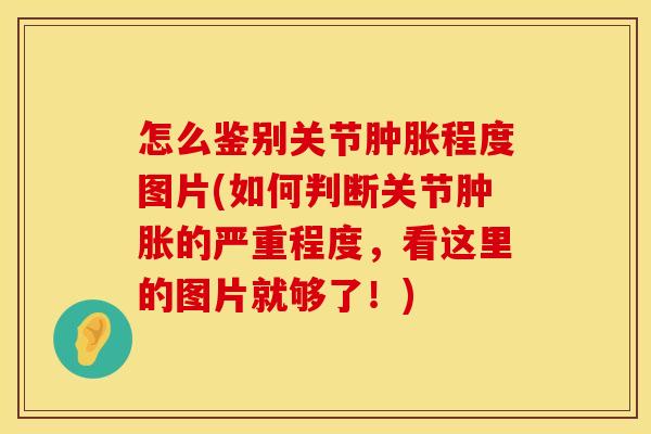 怎么鉴别关节肿胀程度图片(如何判断关节肿胀的严重程度，看这里的图片就够了！)