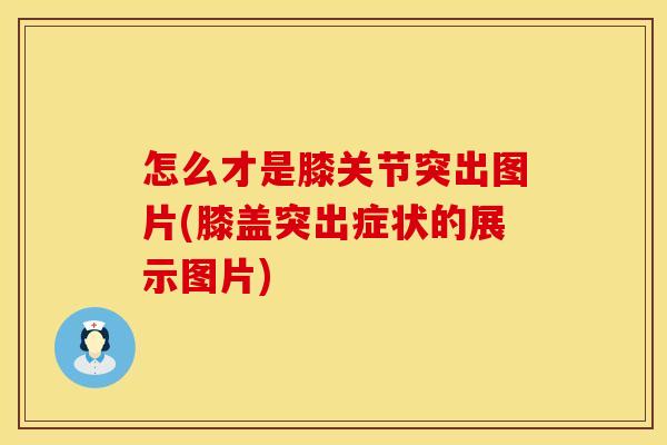 怎么才是膝关节突出图片(膝盖突出症状的展示图片)