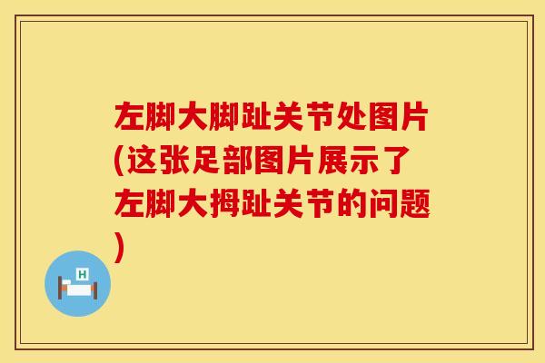 左脚大脚趾关节处图片(这张足部图片展示了左脚大拇趾关节的问题)