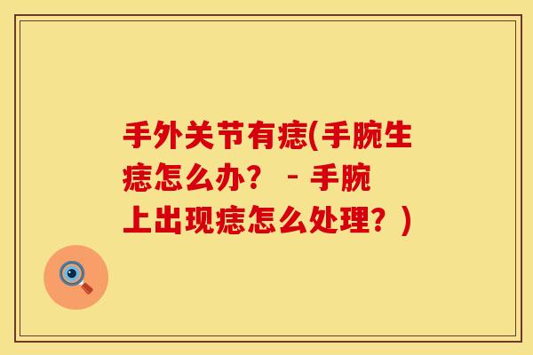 手外关节有痣(手腕生痣怎么办? - 手腕上出现痣怎么处理?)