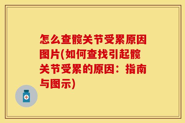 怎么查髋关节受累原因图片(如何查找引起髋关节受累的原因:指南与图示) 怎么查髋关节受累原因图片(如何查找引起髋关节受累的原因:指南与图示)