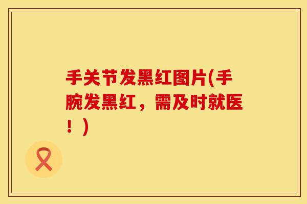 手关节发黑红图片(手腕发黑红，需及时就医！)