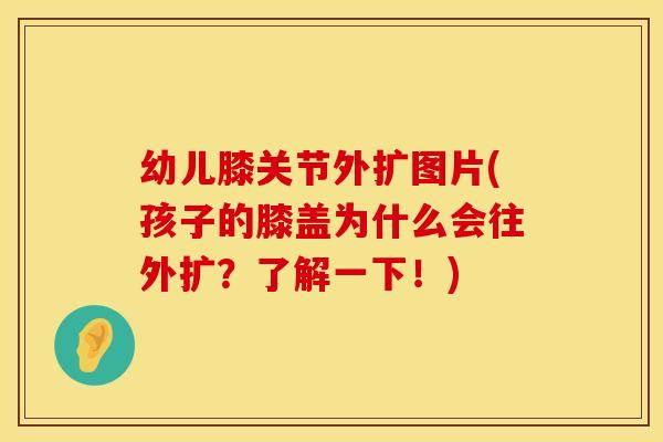幼儿膝关节外扩图片(孩子的膝盖为什么会往外扩？了解一下！)