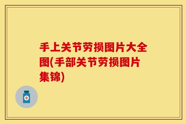 手上关节劳损图片大全图(手部关节劳损图片集锦)