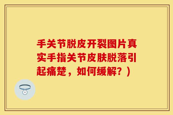手关节脱皮开裂图片真实手指关节皮肤脱落引起痛楚，如何缓解？)