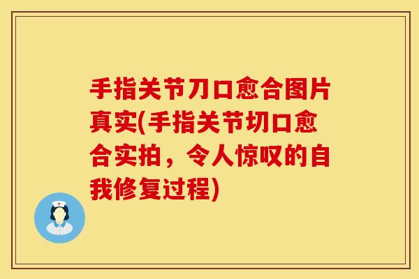 手指关节刀口愈合图片真实(手指关节切口愈合实拍，令人惊叹的自我修复过程)