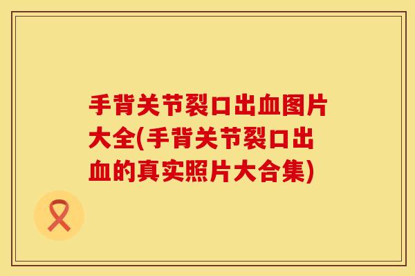 手背关节裂口出图片大全(手背关节裂口出的真实照片大合集) 手背关节裂口出图片大全(手背关节裂口出的真实照片大合集)