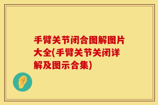 手臂关节闭合图解图片大全(手臂关节关闭详解及图示合集)