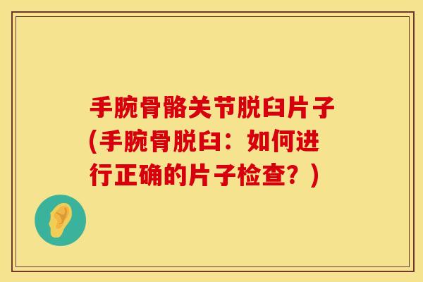 手腕骨骼关节脱臼片子(手腕骨脱臼：如何进行正确的片子检查？)