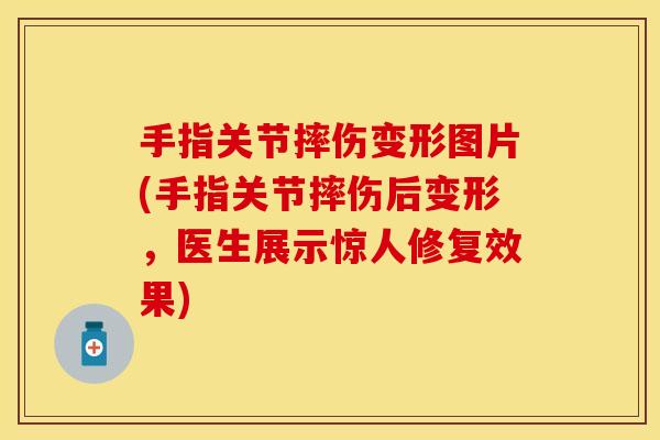 手指关节摔伤变形图片(手指关节摔伤后变形，医生展示惊人修复效果)