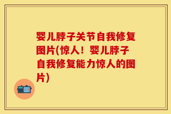 婴儿脖子关节自我修复图片(惊人！婴儿脖子自我修复能力惊人的图片)