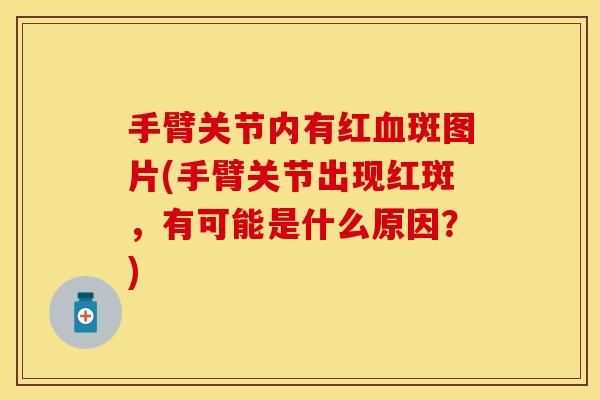 手臂关节内有红血斑图片(手臂关节出现红斑，有可能是什么原因？)