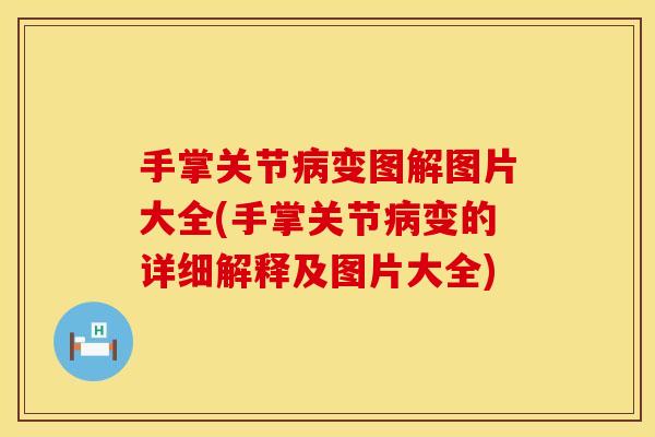 手掌关节病变图解图片大全(手掌关节病变的详细解释及图片大全)