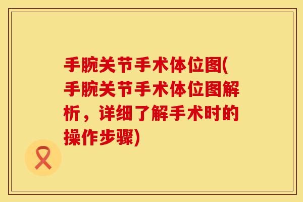 手腕关节手术体位图(手腕关节手术体位图解析，详细了解手术时的操作步骤)