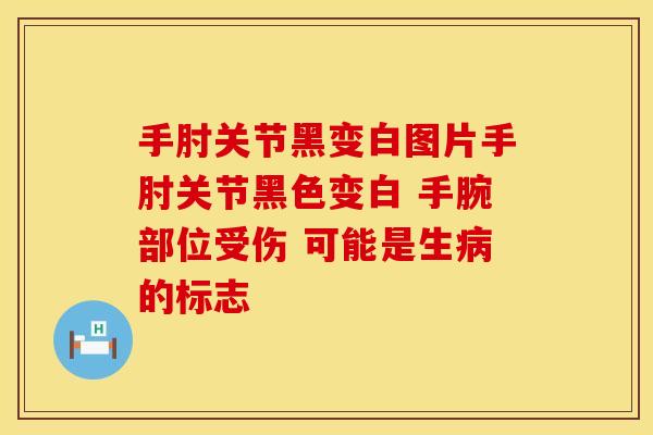 手肘关节黑变白图片手肘关节黑色变白 手腕部位受伤 可能是生的标志