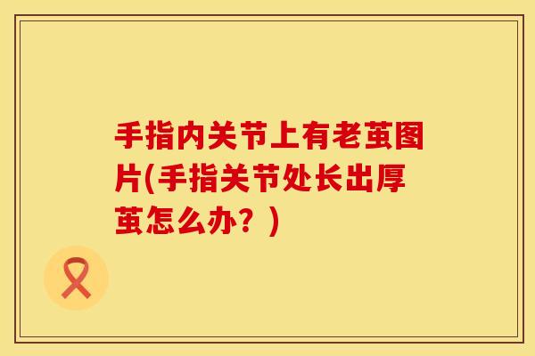 手指内关节上有老茧图片(手指关节处长出厚茧怎么办？)