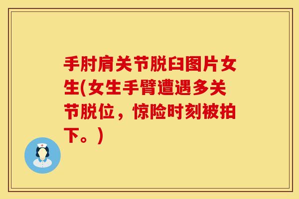 手肘肩关节脱臼图片女生(女生手臂遭遇多关节脱位，惊险时刻被拍下。)