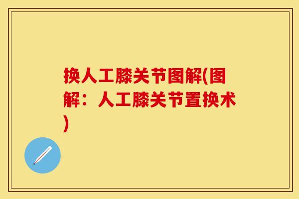 换人工膝关节图解(图解：人工膝关节置换术)