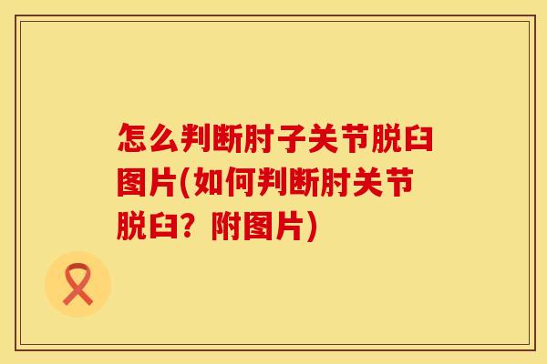 怎么判断肘子关节脱臼图片(如何判断肘关节脱臼？附图片)