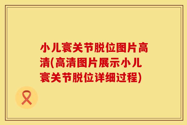 小儿寰关节脱位图片高清(高清图片展示小儿寰关节脱位详细过程)