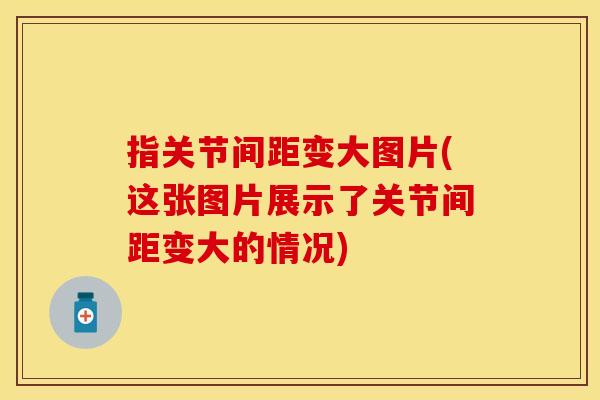 指关节间距变大图片(这张图片展示了关节间距变大的情况)