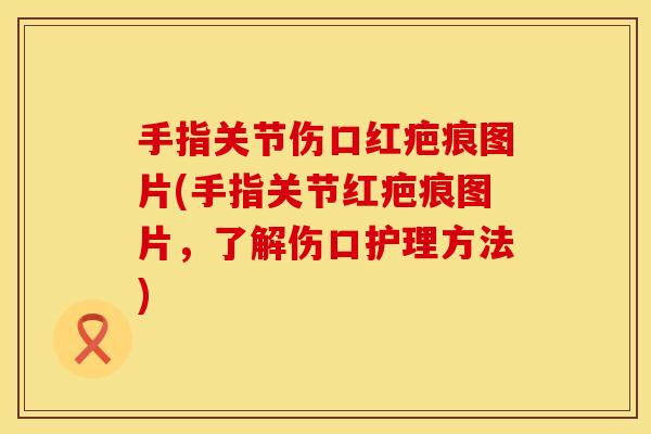 手指关节伤口红疤痕图片(手指关节红疤痕图片，了解伤口护理方法)