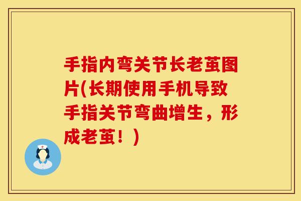 手指内弯关节长老茧图片(长期使用手机导致手指关节弯曲增生，形成老茧！)