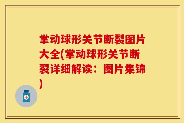 掌动球形关节断裂图片大全(掌动球形关节断裂详细解读：图片集锦)