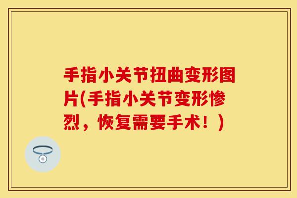 手指小关节扭曲变形图片(手指小关节变形惨烈，恢复需要手术！)