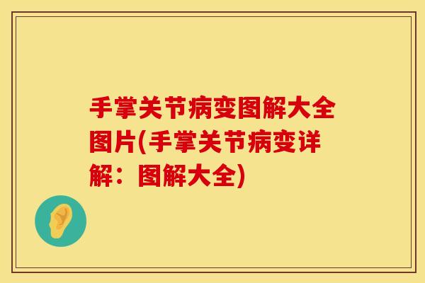 手掌关节病变图解大全图片(手掌关节病变详解：图解大全)