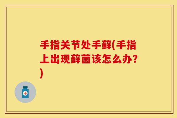 手指关节处手藓(手指上出现藓菌该怎么办？)