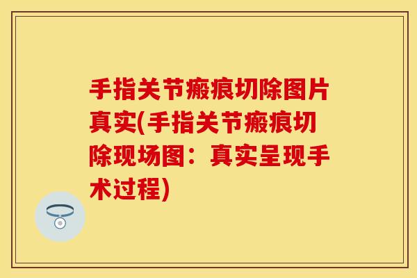 手指关节瘢痕切除图片真实(手指关节瘢痕切除现场图：真实呈现手术过程)