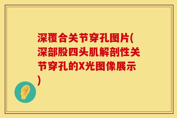 深覆合关节穿孔图片(深部股四头肌解剖性关节穿孔的X光图像展示)
