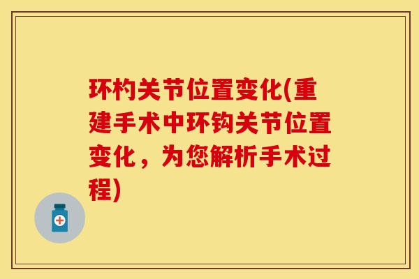 环杓关节位置变化(重建手术中环钩关节位置变化，为您解析手术过程)