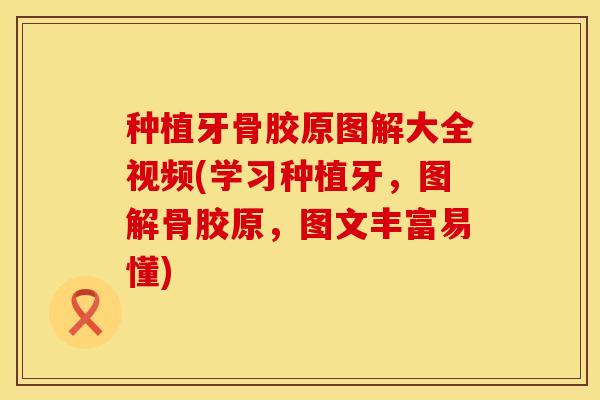 种植牙骨胶原图解大全视频(学习种植牙，图解骨胶原，图文丰富易懂)