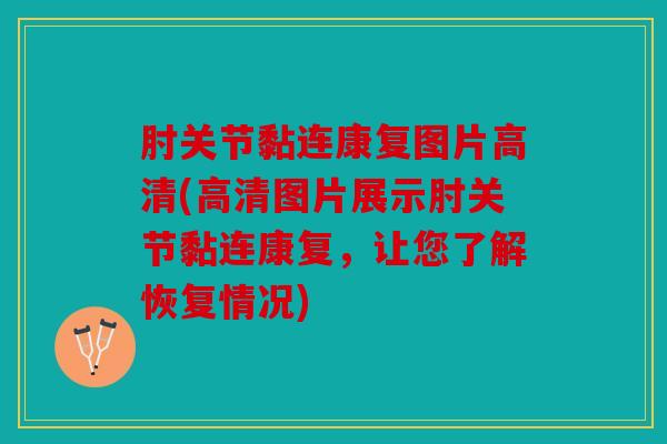 肘关节黏连康复图片高清(高清图片展示肘关节黏连康复，让您了解恢复情况)