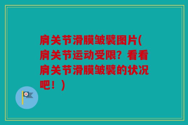 肩关节滑膜皱襞图片(肩关节运动受限？看看肩关节滑膜皱襞的状况吧！)