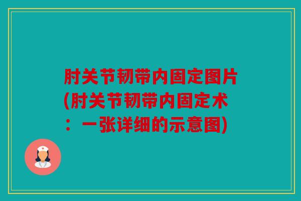 肘关节韧带内固定图片(肘关节韧带内固定术：一张详细的示意图)