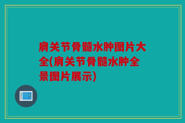 肩关节骨髓水肿图片大全(肩关节骨髓水肿全景图片展示)