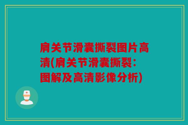 肩关节滑囊撕裂图片高清(肩关节滑囊撕裂：图解及高清影像分析)