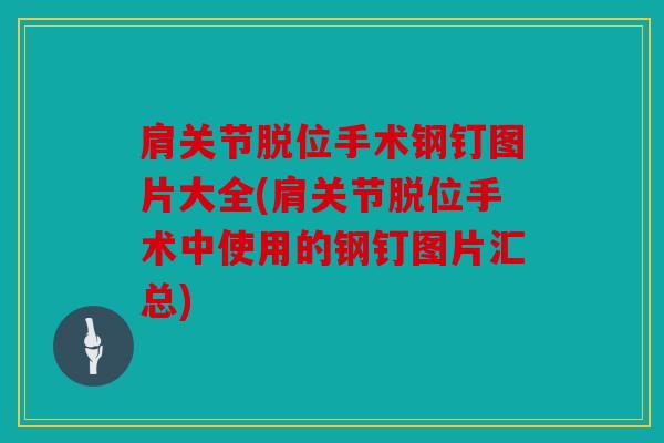 肩关节脱位手术钢钉图片大全(肩关节脱位手术中使用的钢钉图片汇总)