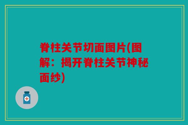 脊柱关节切面图片(图解：揭开脊柱关节神秘面纱)
