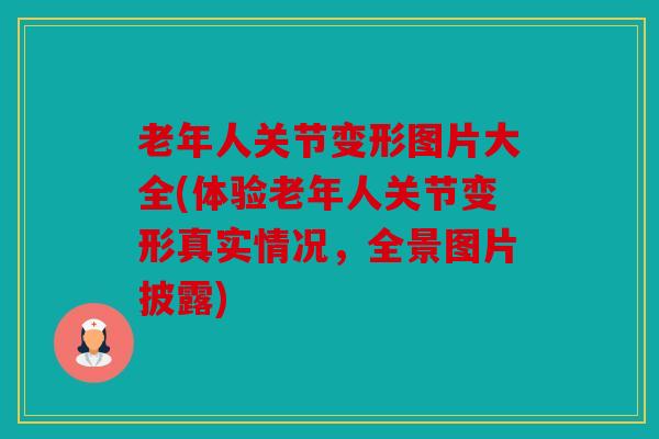 老年人关节变形图片大全(体验老年人关节变形真实情况，全景图片披露)