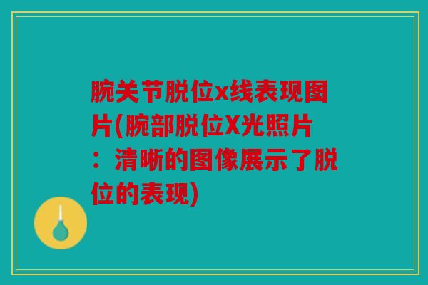 腕关节脱位x线表现图片(腕部脱位X光照片：清晰的图像展示了脱位的表现)